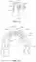 Fig. 15 - Modular aligner devices and methods for orthodontic treatment