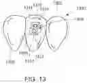 Fig. 17 - Modular aligner devices and methods for orthodontic treatment