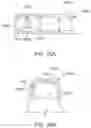 Fig. 20 - Modular aligner devices and methods for orthodontic treatment