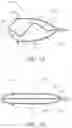 Fig. 08 - Intravascular filter cut from sheet metal