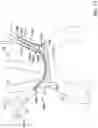 Fig. 21 - Systems and methods for protecting the cerebral vasculature