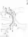 Fig. 23 - Systems and methods for protecting the cerebral vasculature