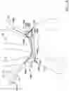 Fig. 24 - Systems and methods for protecting the cerebral vasculature