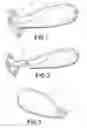 Fig. 02 - Neovaginal prosthesis