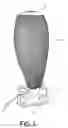 Fig. 03 - Neovaginal prosthesis