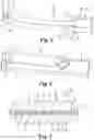 Fig. 04 - Cell encapsulation device including a porous tube