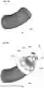 Fig. 08 - Aortic graft occluder