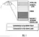 Fig. 02 - DEVICE TO FACILITATE PERFORMING DESCEMET'S MEMBRANE ENDOTHELIAL KERATOPLASTY (DMEK)
