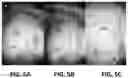 Fig. 06 - DEVICE TO FACILITATE PERFORMING DESCEMET'S MEMBRANE ENDOTHELIAL KERATOPLASTY (DMEK)