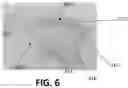 Fig. 07 - DEVICE TO FACILITATE PERFORMING DESCEMET'S MEMBRANE ENDOTHELIAL KERATOPLASTY (DMEK)
