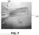Fig. 08 - DEVICE TO FACILITATE PERFORMING DESCEMET'S MEMBRANE ENDOTHELIAL KERATOPLASTY (DMEK)