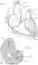 Fig. 02 - Heart valve docking coils and systems