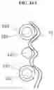 Fig. 13 - Heart valve docking coils and systems