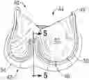 Fig. 01 - Low gradient prosthetic heart valves