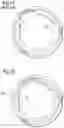 Fig. 10 - Low gradient prosthetic heart valves