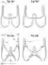 Fig. 12 - Low gradient prosthetic heart valves