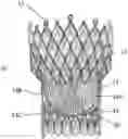 Fig. 01 - ENGINEERED TISSUE PROSTHESIS