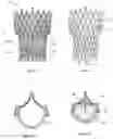 Fig. 02 - ENGINEERED TISSUE PROSTHESIS
