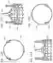 Fig. 10 - Hybrid heart valves