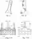 Fig. 14 - Hybrid heart valves