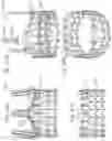 Fig. 17 - Hybrid heart valves