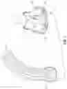 Fig. 02 - Methods of preparing and delivering a dry bioprosthetic valved conduit