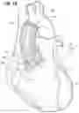 Fig. 03 - Methods of preparing and delivering a dry bioprosthetic valved conduit