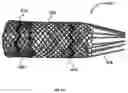 Fig. 02 - MEDICAL IMPLANT DEPLOYMENT TOOL