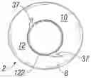 Fig. 01 - Method of implanting a spacer body in a mitral valve