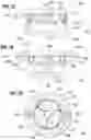 Fig. 11 - Method of implanting a spacer body in a mitral valve