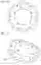 Fig. 64 - Method of implanting a spacer body in a mitral valve