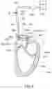 Fig. 06 - AORTIC VALVE EVALUATION ASSISTING JIG