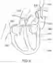 Fig. 10 - AORTIC VALVE EVALUATION ASSISTING JIG