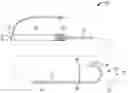 Fig. 01 - SYSTEMS AND METHODS FOR POSITIONING MEDICAL DEVICES RELATIVE TO HEART VALVE ANATOMY