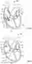 Fig. 05 - SYSTEMS AND METHODS FOR POSITIONING MEDICAL DEVICES RELATIVE TO HEART VALVE ANATOMY