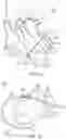Fig. 03 - Systems and devices for setting an anchor