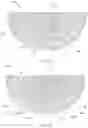Fig. 05 - Bone graft cage