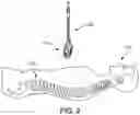 Fig. 03 - Spinal fusion implant