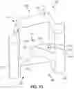 Fig. 12 - Spinal fusion implant