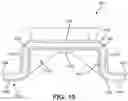 Fig. 14 - Spinal fusion implant