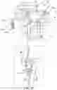 Fig. 25 - Spinal fusion implant