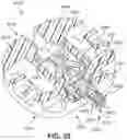 Fig. 35 - Spinal fusion implant