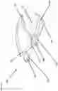 Fig. 05 - Composite joint implant