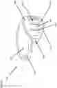 Fig. 06 - Composite joint implant