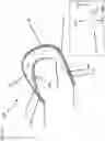 Fig. 13 - Composite joint implant