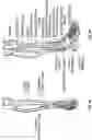 Fig. 05 - TALAR IMPLANT FOR MODIFYING JOINT KINEMATICS