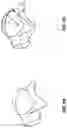 Fig. 06 - TALAR IMPLANT FOR MODIFYING JOINT KINEMATICS