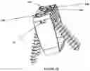 Fig. 10 - Bi-directional fixating/locking transvertebral body screw/intervertebral cage stand-alone constructs