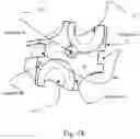 Fig. 26 - Bi-directional fixating/locking transvertebral body screw/intervertebral cage stand-alone constructs
