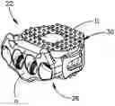 Fig. 01 - Intervertebral implants, systems, and methods of use
